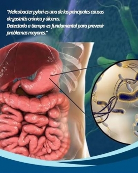  - Quantum Medical Lleida